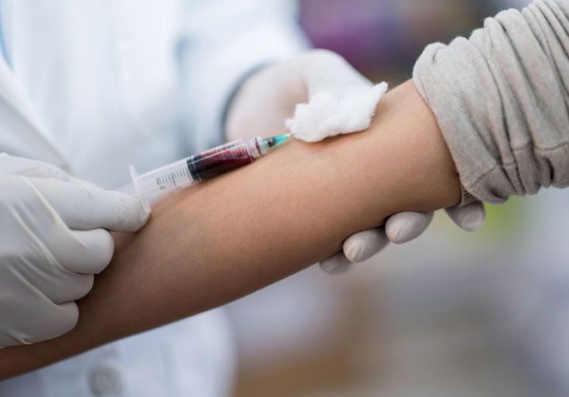 ACTH (Cosyntropin) Stimulation Test