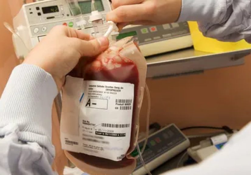 Myelodysplastic Syndromes (MDS): Treatment Options