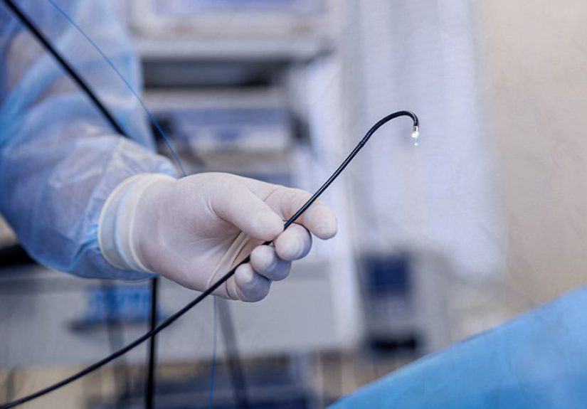 Can colonoscopy detect anal cancer? Diagnostic tests