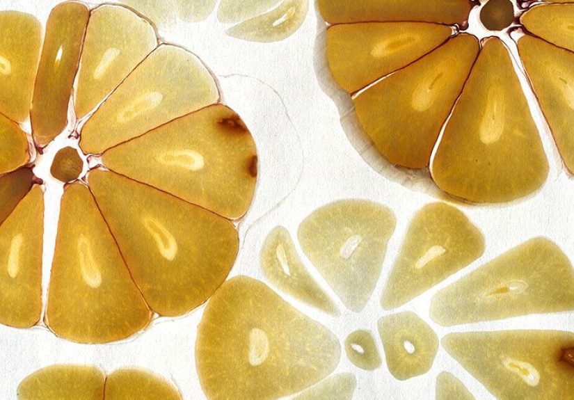 Does garlic lower cholesterol?