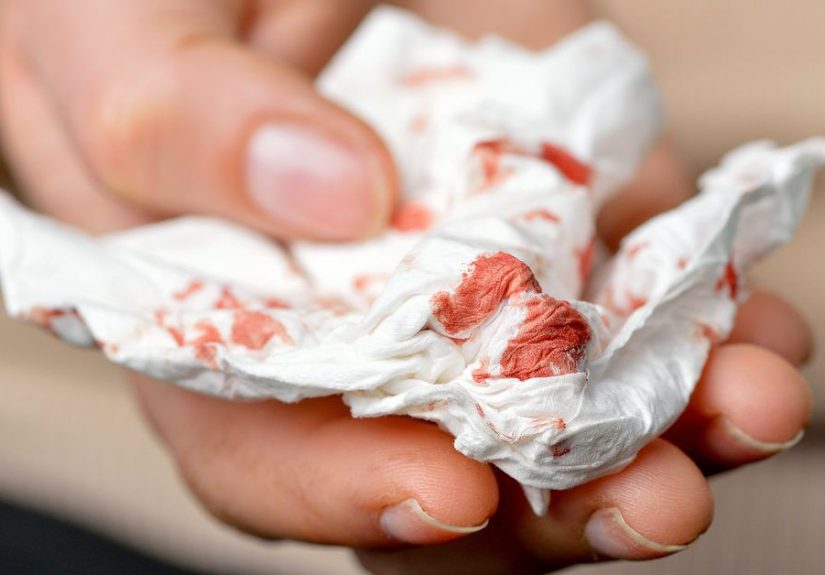 Hemorrhage: Causes, Emergency Symptoms, First Aid & More