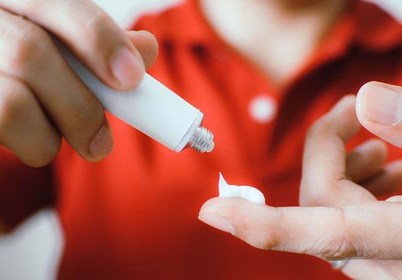 Hydrocortisone for Acne: Does It Work, Safety, and More