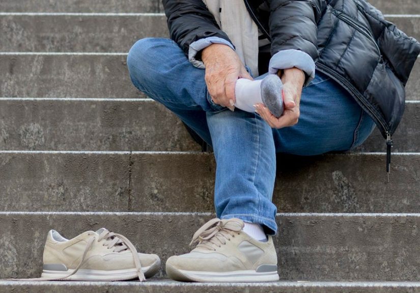 Intermittent Claudication: Definition, Symptoms, Treatment, and More