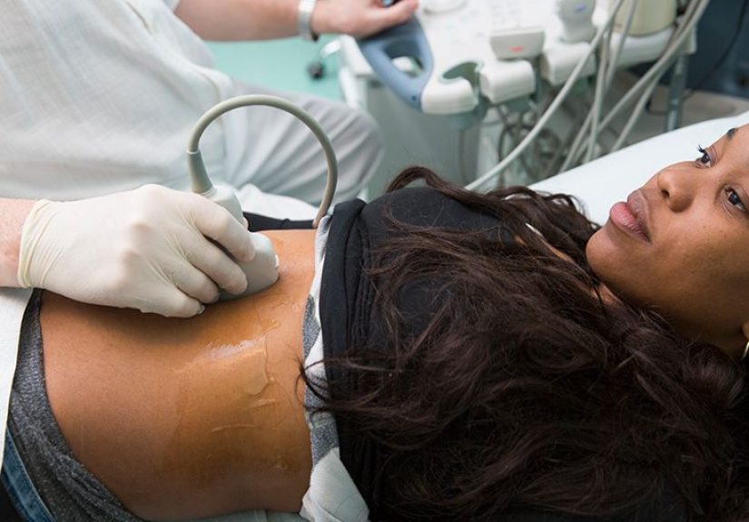 Placenta previa: Symptoms, ultrasound, and treatment