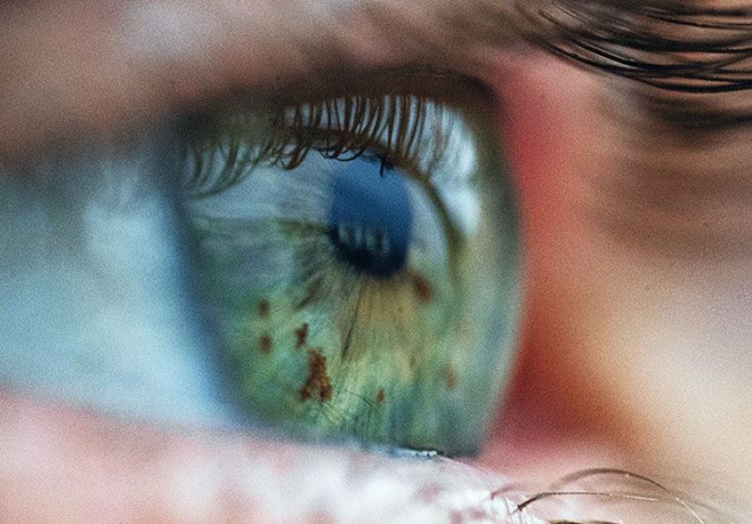 Retinal hemorrhage: Causes, risk factors, and symptoms