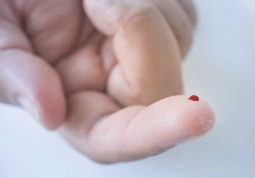 Thick Blood (Hypercoagulability): Causes, Treatment, and Test