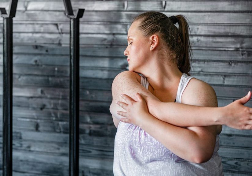 Thoracic Outlet Syndrome: Everything You Need to Know