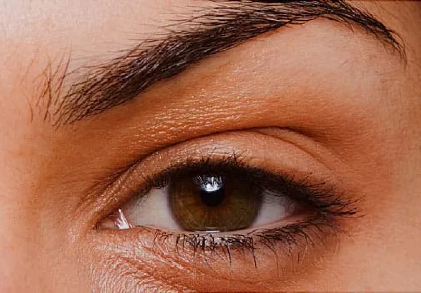 What Do Your Eyes Say About Your health?