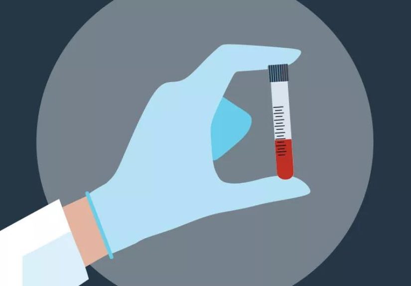 When Should You Get Cholesterol Checked?