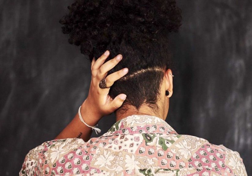 10 Home Remedies to Get Rid of Dandruff