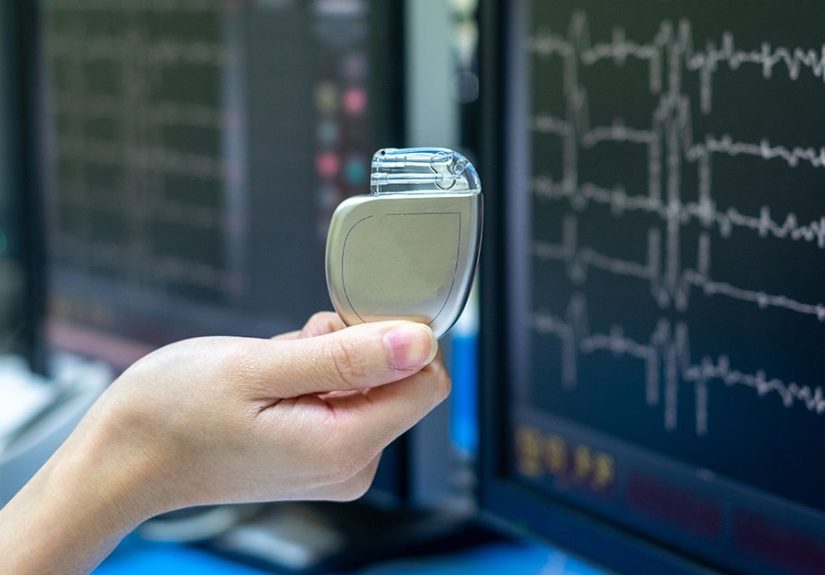 Arrhythmia Treatment: Medications, Procedures, and Devices