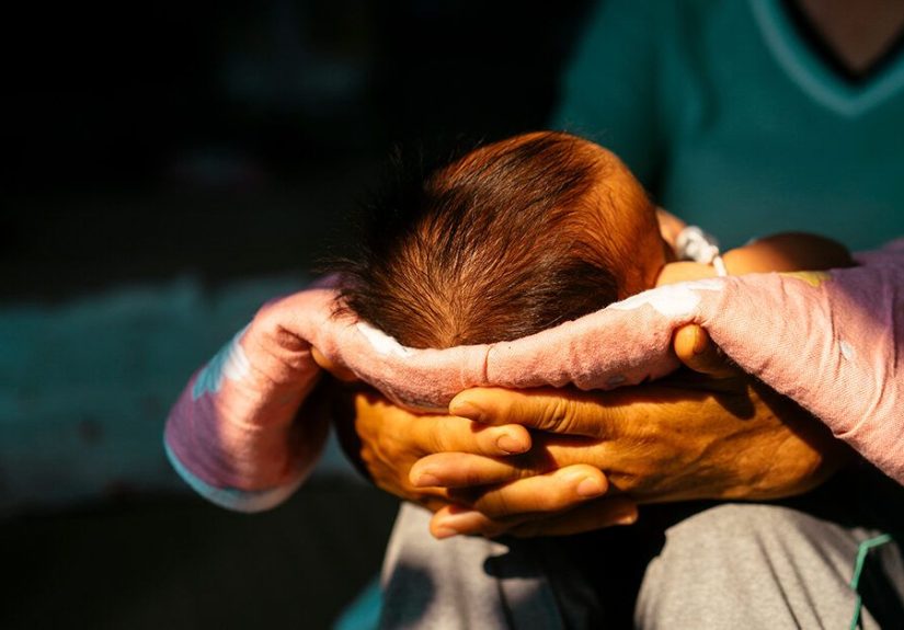 Beckwith-Wiedemann Syndrome: Symptoms, Diagnosis, and Effects