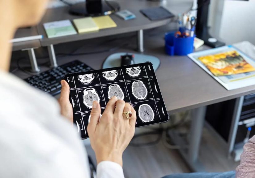Comparing Epidural vs. Subdural Hematomas