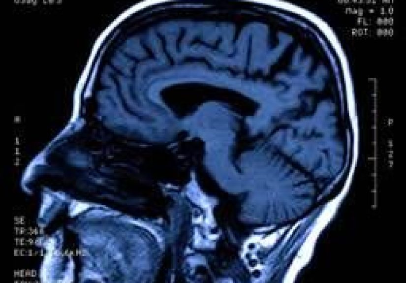 Imagination - how and where does it occur in the brain?