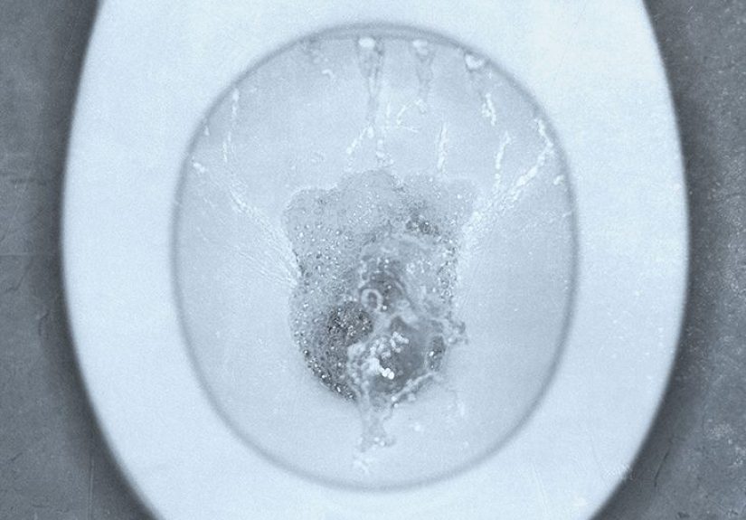Mucus in urine: Causes, tests, and treatment