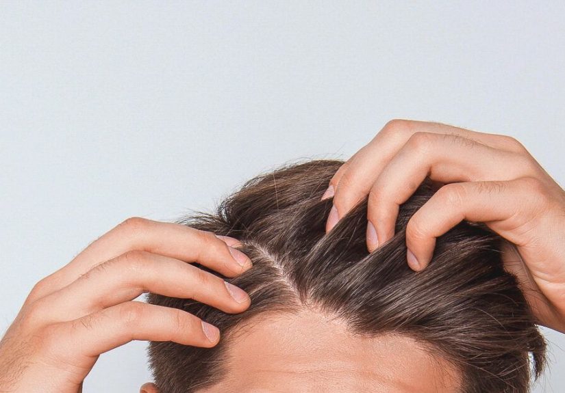 Scabs and Sores on Scalp: Pictures, Causes, Treatment