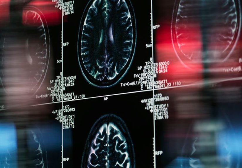 What do the brain ventricles do and what conditions do they relate to?