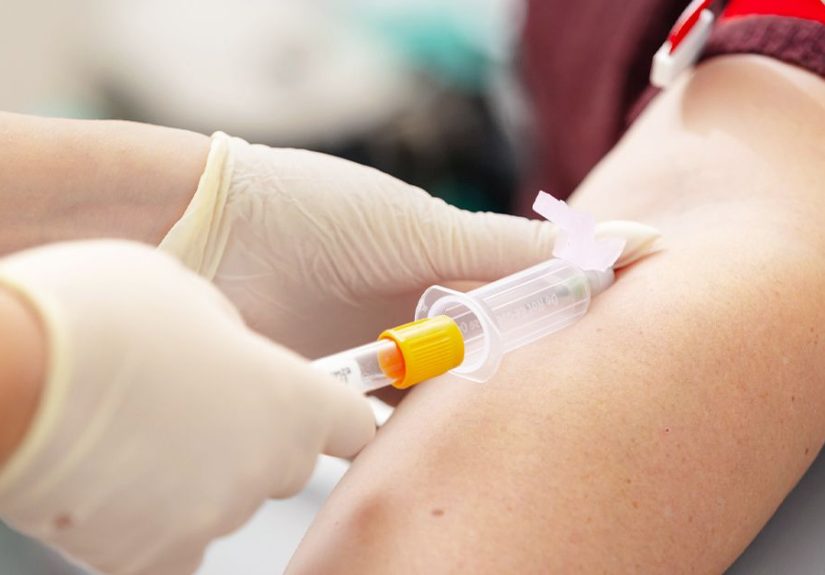 What to Know About the Boston Heart Cholesterol Balance Test