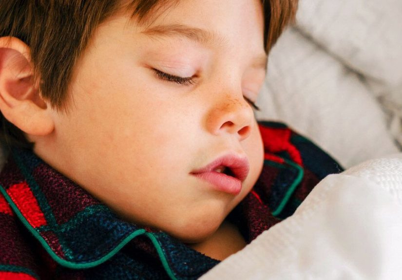 Woke Up with Swollen Lip: Causes and Treatment