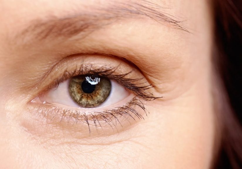 Wrinkle Fillers