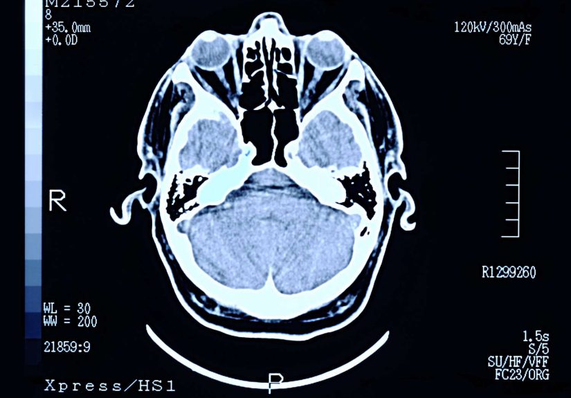 DICOM File (What It Is and How to Open One)