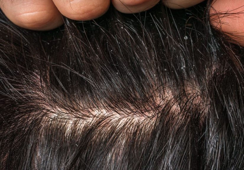 How Often Should You Wash Your Hair?
