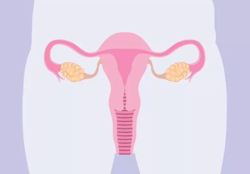 How To Get Pregnant With PCOS