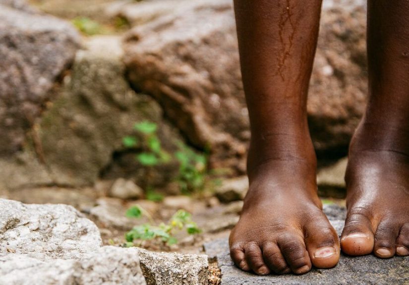 Is My Foot Pain Caused By Sciatica Or Plantar Fasciitis?
