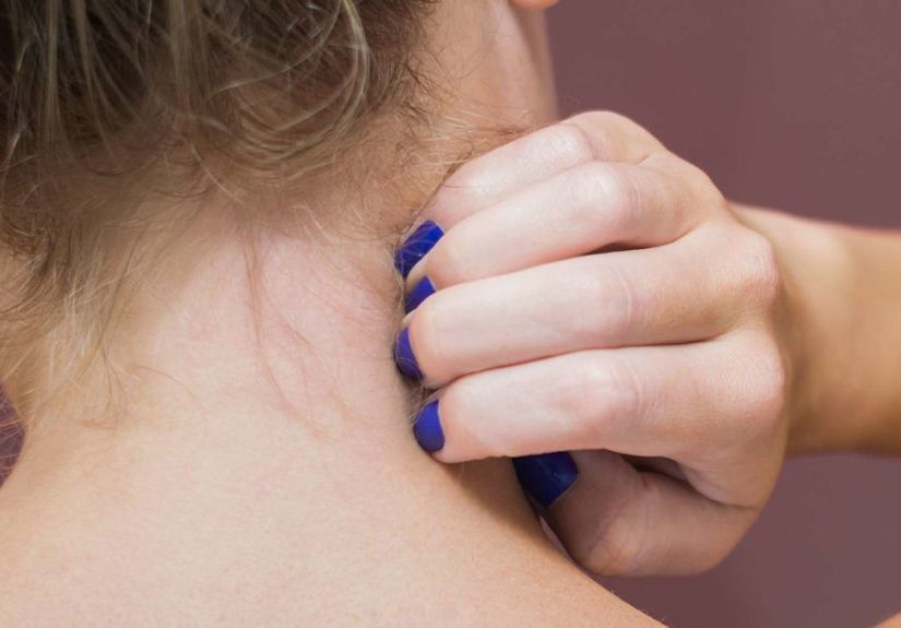 Itchy Neck: Causes, Remedies, and Prevention