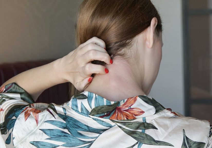 Psoriasis Pictures, Treatments, and Symptoms