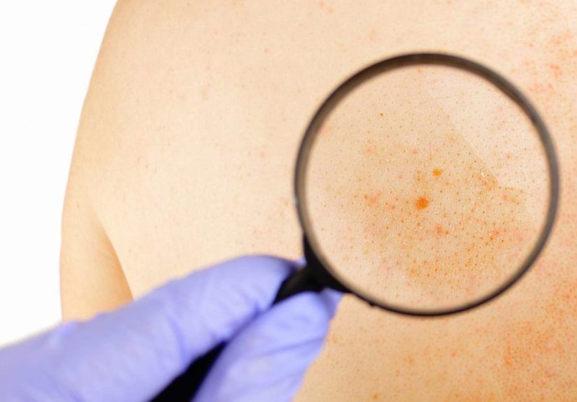 Signs and Symptoms: Definition, Importance, and Uses