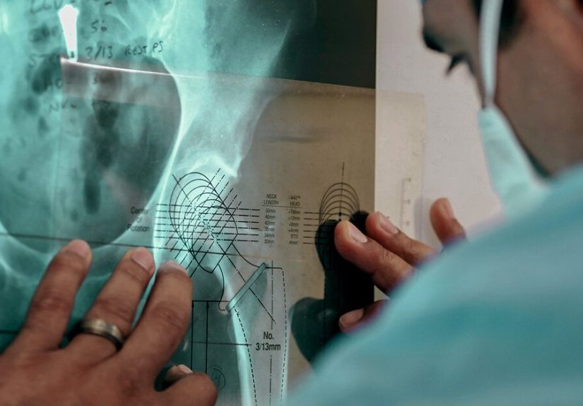 Types of Hip Surgery and What They Are Used to Treat