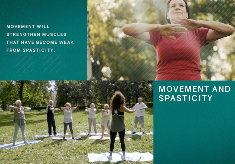 Why It’s Important to Move and Stretch Daily With Spasticity