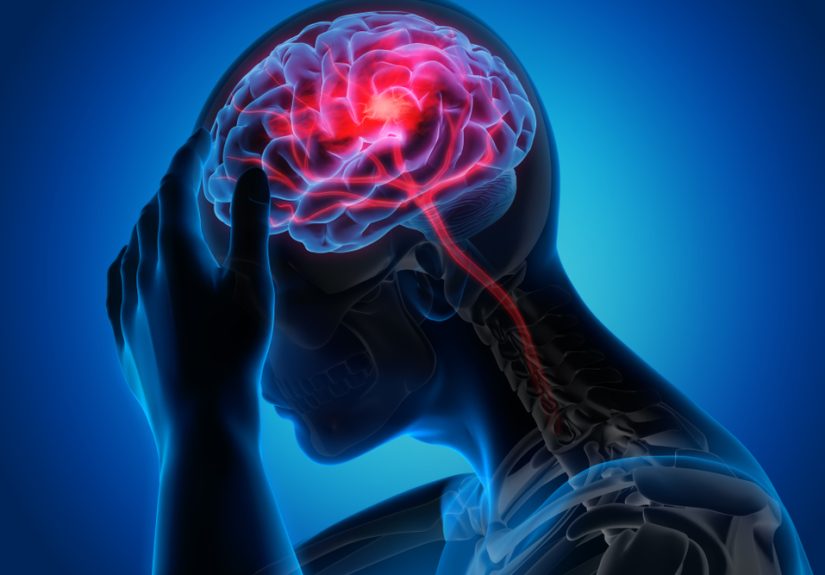A better future in migraine management: the essential role of primary care
