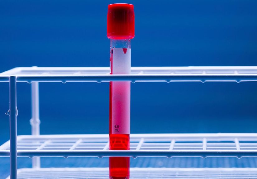 Cancer Virus: 8 Viruses Linked to Cancer and How to Avoid Them