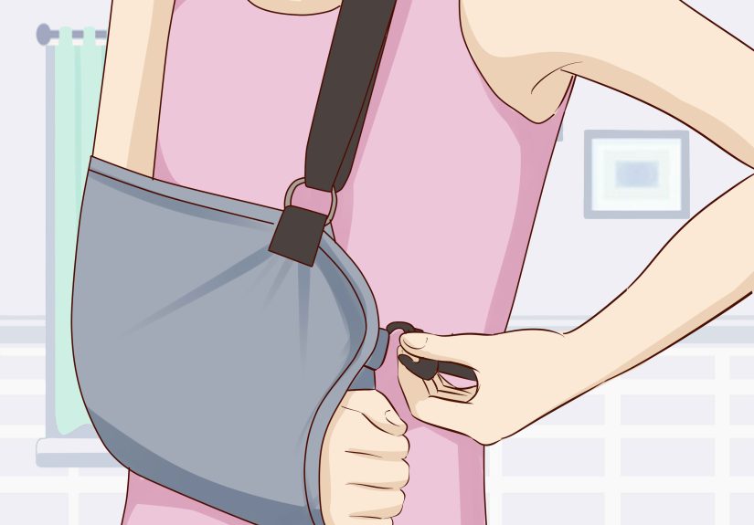 How to Dress After a Shoulder Surgery