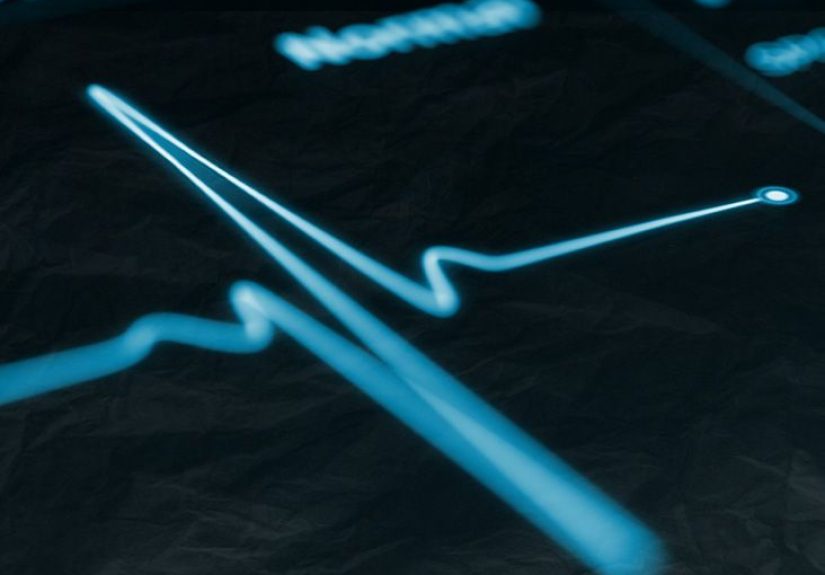 Left bundle branch block: Symptoms, causes, and treatment