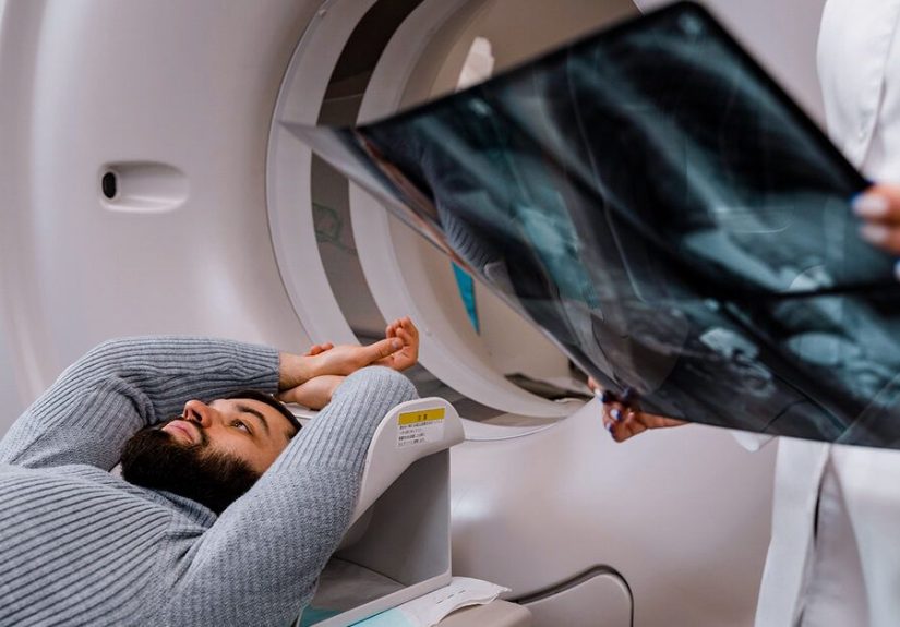 Radiation for Esophageal Cancer: Benefits, Risks, Side Effects