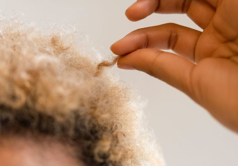 Trichotillomania: Causes, Symptoms, Treatment, & More